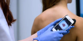 Telemedicina in Dermatologia