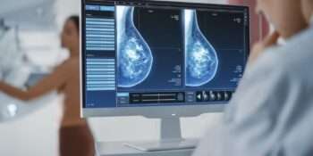 Mammografia Digitale con Tomosintesi